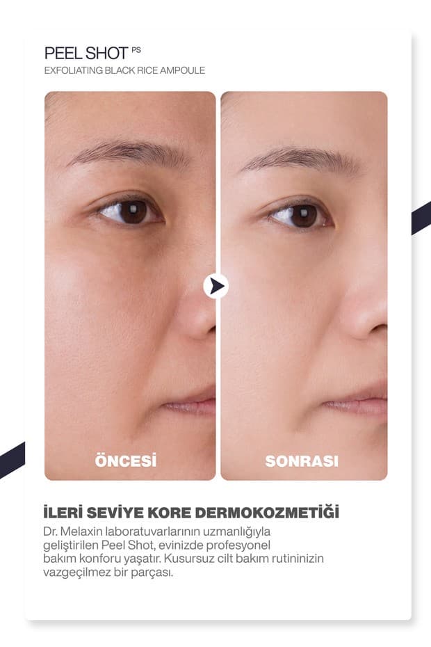 Siyah Pirinç Özlü | Gözenek & Siyah Nokta Karşıtı | Arındırıcı Peeling Serum 80ml