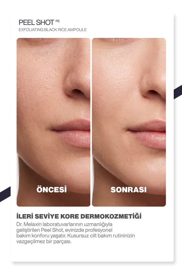 Siyah Pirinç Özlü | Gözenek & Siyah Nokta Karşıtı | Arındırıcı Peeling Serum 80ml
